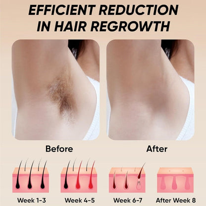 IPL hair removal epilator results on leg skin, before and after