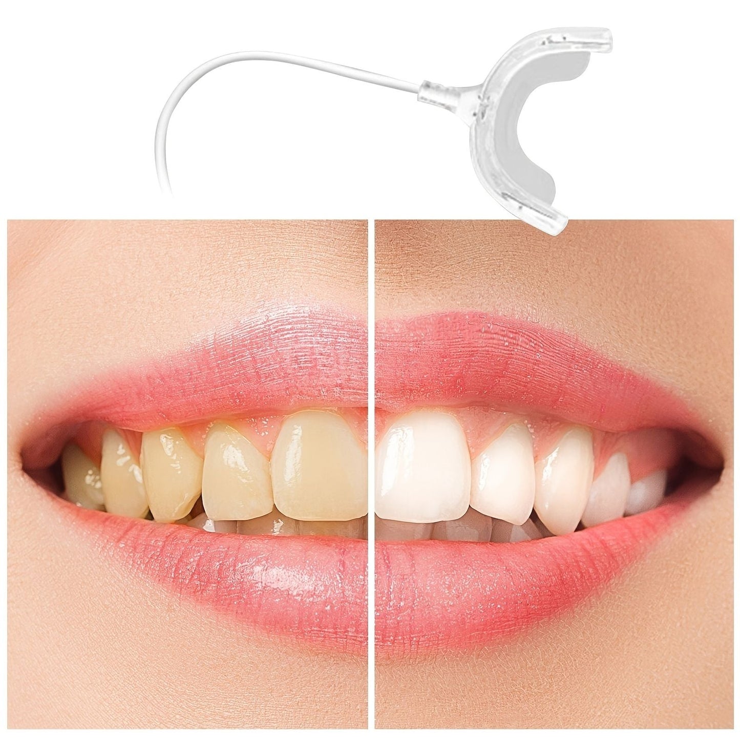 Rechargeable LED Teeth Whitening Tool - Portable, Electric & Mini Light Oral Care for a Brighter Smile! - Renee Lane Company