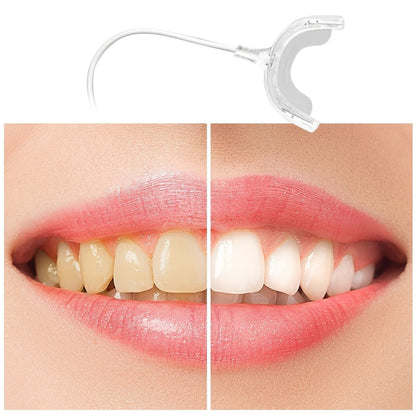 Rechargeable LED Teeth Whitening Tool - Portable, Electric & Mini Light Oral Care for a Brighter Smile! - Renee Lane Company