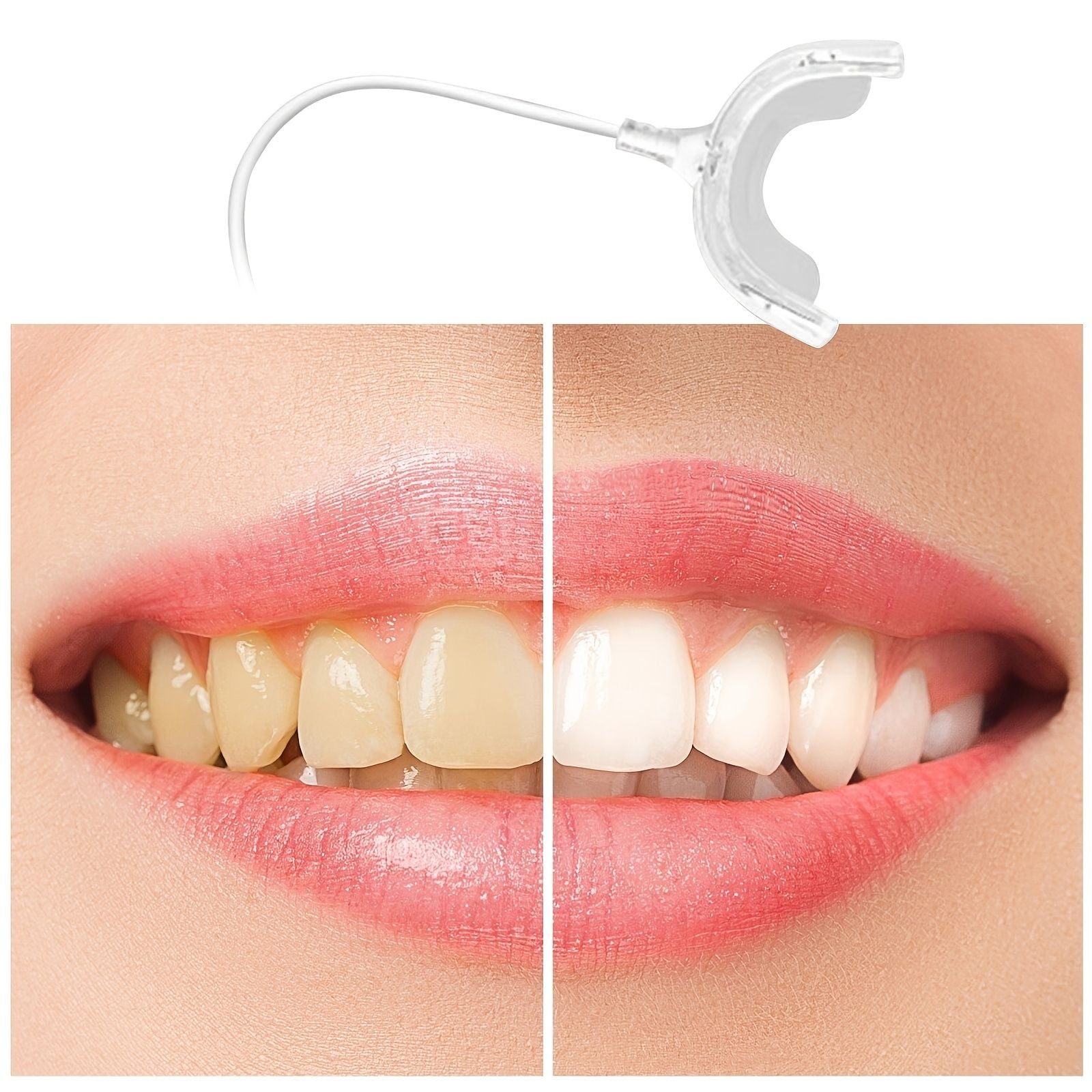 Rechargeable LED Teeth Whitening Tool - Portable, Electric & Mini Light Oral Care for a Brighter Smile! - Renee Lane Company