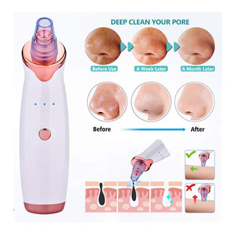Rejuvenate Your Skin - Blackhead Remover Vacuum - Facial Pore Vacuum Extractor Electric Pore Cleaner - Renee Lane Company