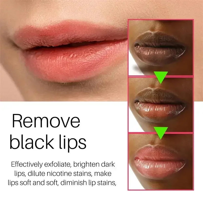 Remove Dark Lip Balm Fast Lightening Pink Lip Exfoliating Fade Lip Line Dead Skin Moisturizer Korean Care Products Beauty Health