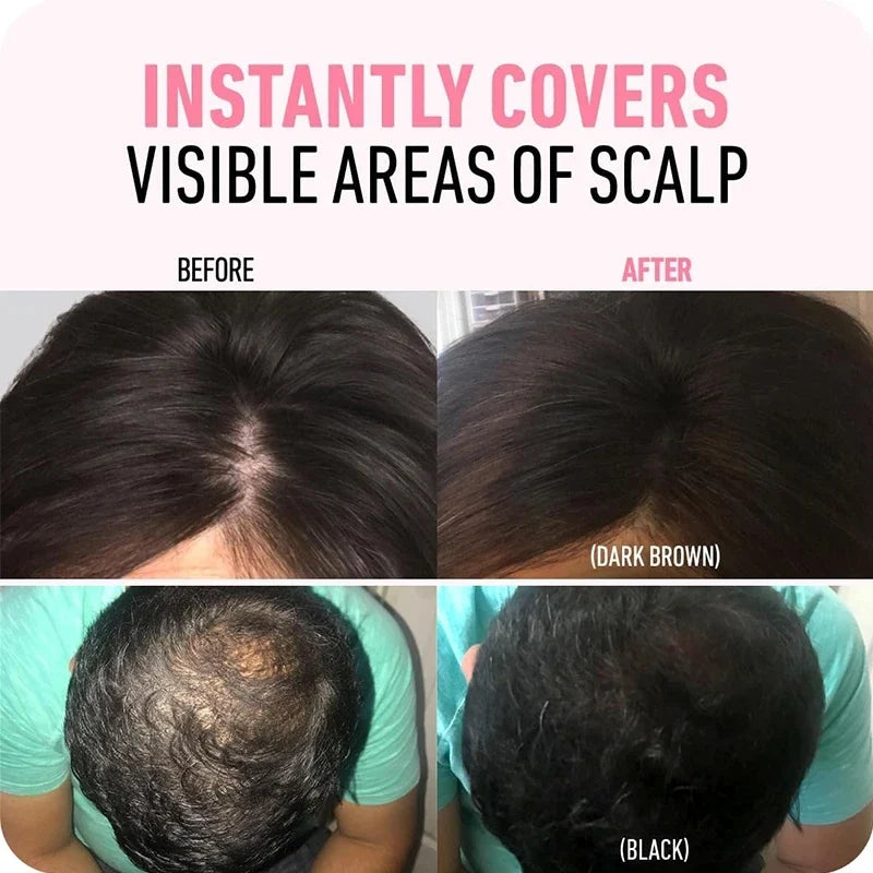 Hairline powder scalp coverage before-and-after, dark brown result