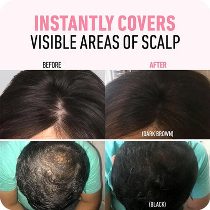 Hairline powder scalp coverage before-and-after, dark brown result