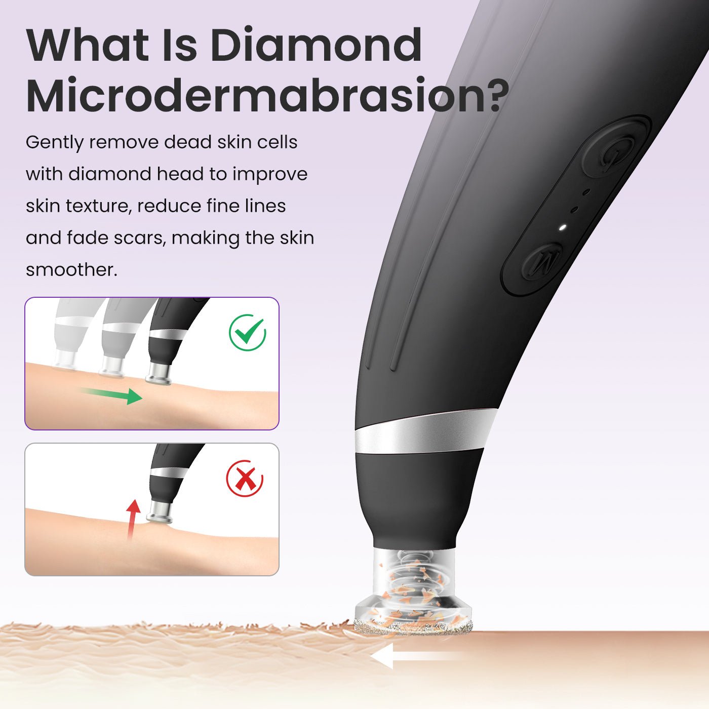 Shape Tactics 12-Tip Diamond Microdermabrasion Kit - Renee Lane Company