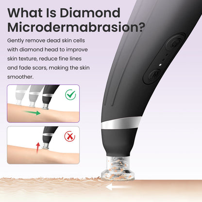 Shape Tactics 12-Tip Diamond Microdermabrasion Kit - Renee Lane Company