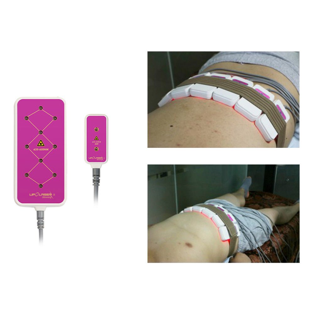 Shape Tactics 160mW 10-Pad Slimming Body System - Renee Lane Company