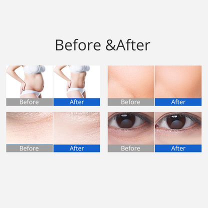 Shape Tactics 3-in-1 40K Ultrasonic Cavitation RF Slimming Machine - Renee Lane Company