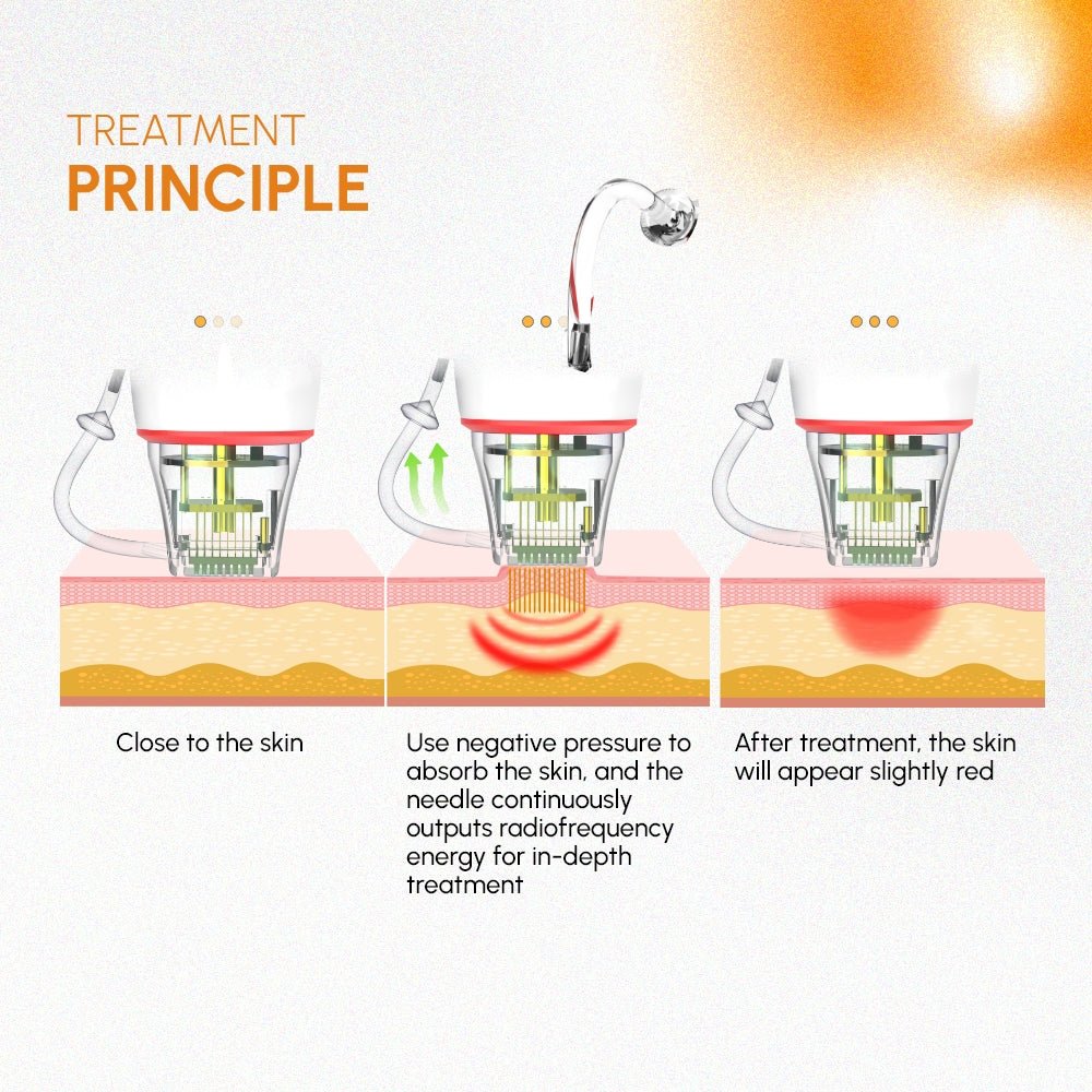 Shape Tactics 3-in-1 Targeted RF Microneedling System - Renee Lane Company
