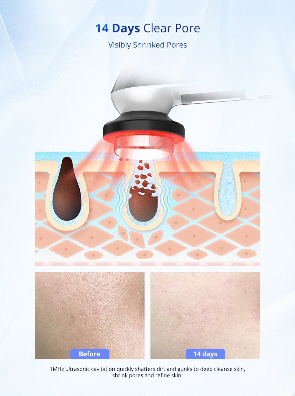 Shape Tactics 3-in-1 Ultrasonic Facial EMS LED Photon Therapy - Renee Lane Company