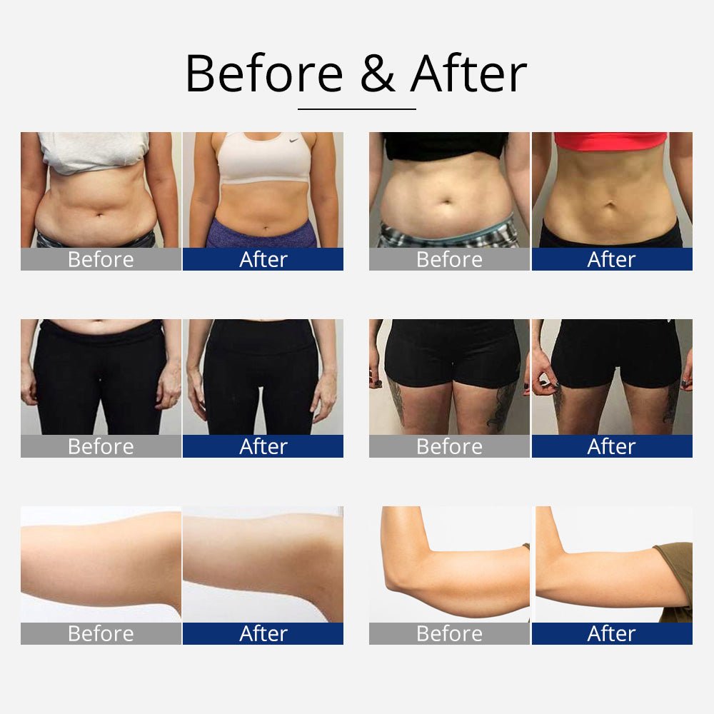 Shape Tactics 360° RF Cavitation & Vacuum Body Contouring System - Renee Lane Company