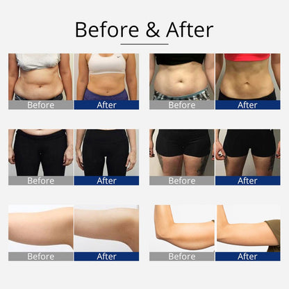 Shape Tactics 360° RF Cavitation & Vacuum Body Contouring System - Renee Lane Company