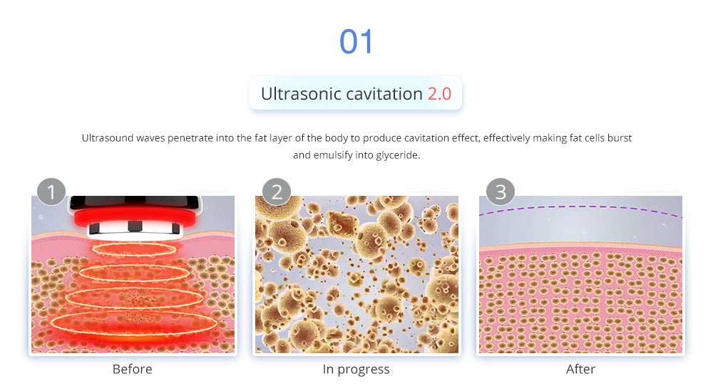 Shape Tactics 4-in-1 Cryolipolysis Cavitation RF Body Contouring System - Renee Lane Company