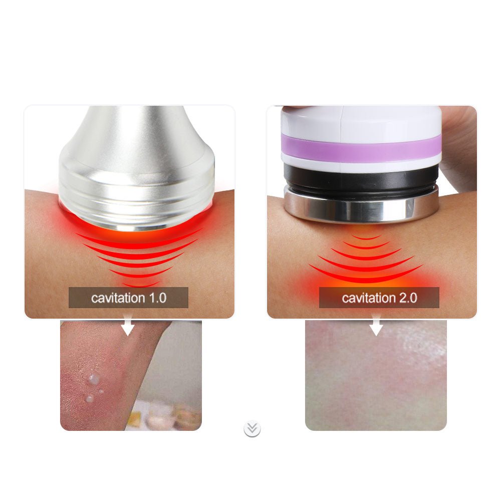 Shape Tactics 40K Cavitation 2.0 Body Contouring System - Renee Lane Company