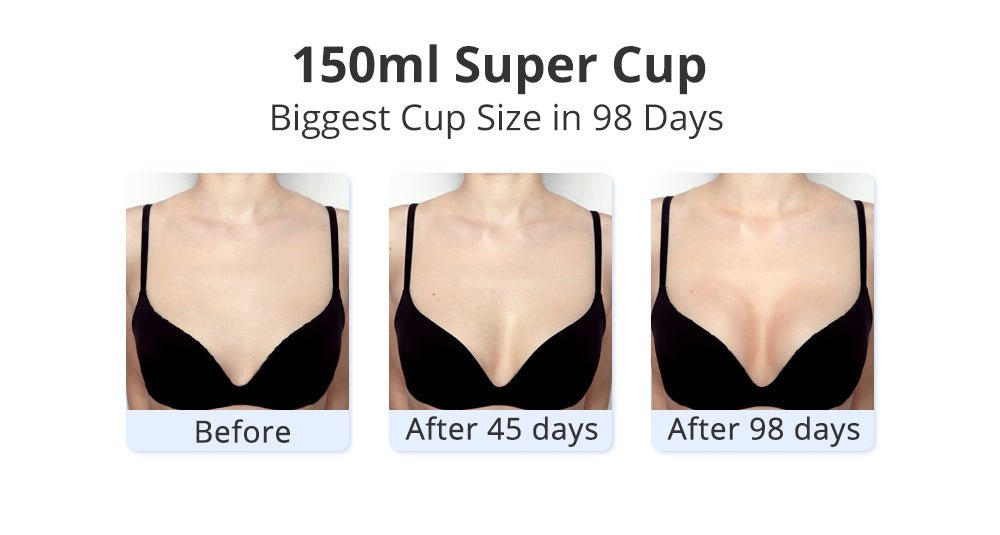 Shape Tactics 40K Cavitation and RF Vacuum Contouring System - Renee Lane Company