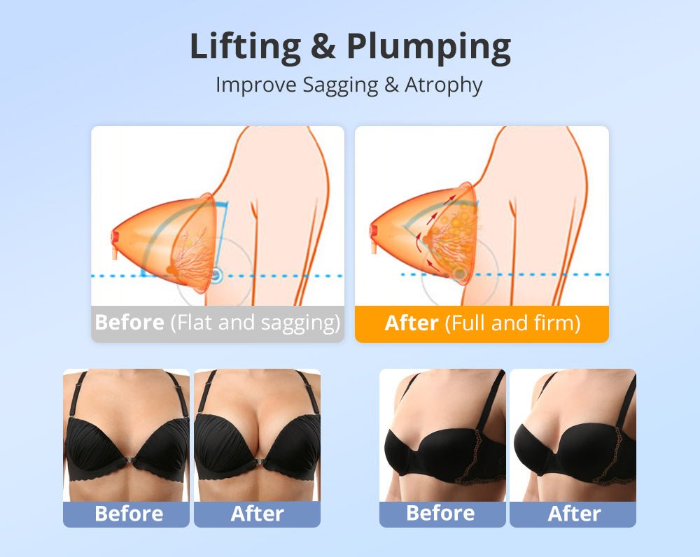 Shape Tactics 40K Cavitation and RF Vacuum Contouring System - Renee Lane Company