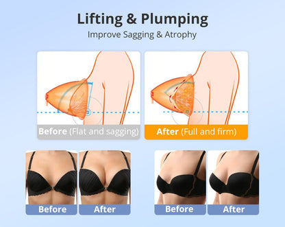 Shape Tactics 40K Cavitation and RF Vacuum Contouring System - Renee Lane Company