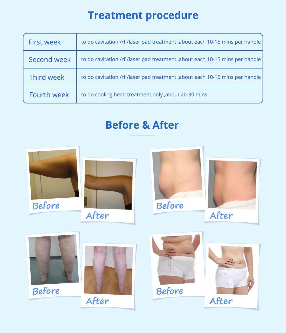 Shape Tactics 5-in-1 Cavitation Cryolipolysis Lipo Laser System - Renee Lane Company