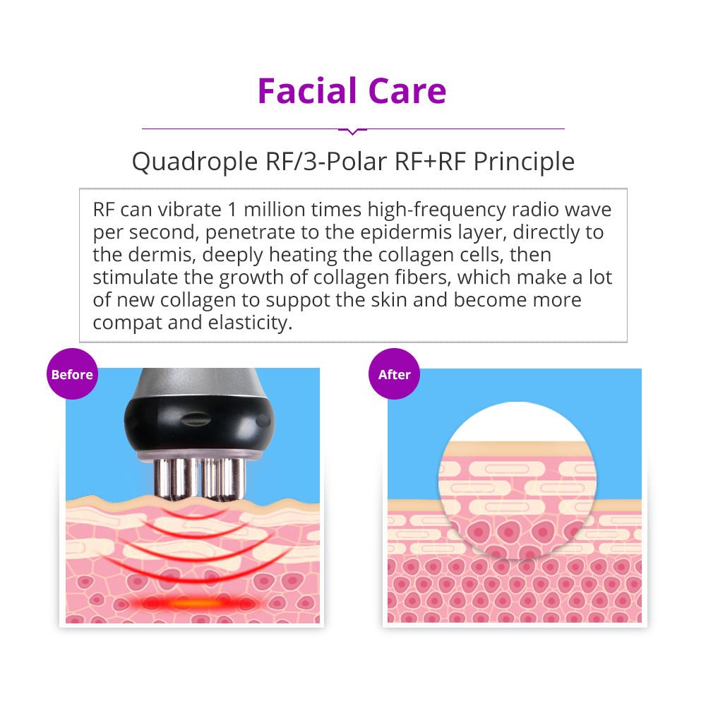 Shape Tactics 5-in-1 Cavitation RF Vacuum Body Contouring System - Renee Lane Company