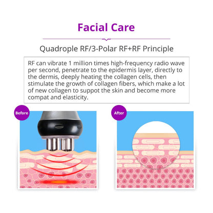Shape Tactics 5-in-1 Cavitation RF Vacuum Body Contouring System - Renee Lane Company