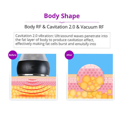 Shape Tactics 5-in-1 Cavitation RF Vacuum Body Contouring System - Renee Lane Company