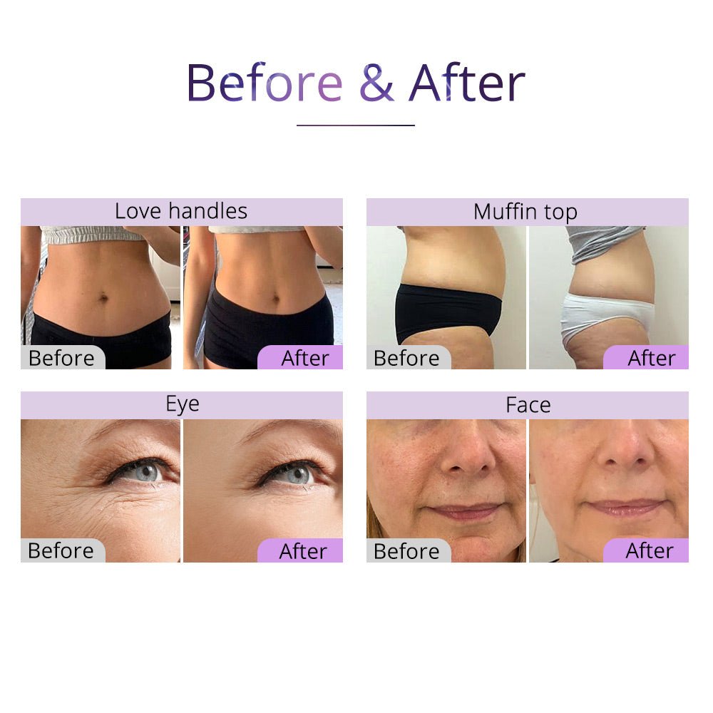 Shape Tactics 5-in-1 Cavitation Vacuum RF Body Contouring System - Renee Lane Company