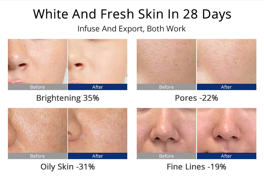 Shape Tactics 5-in-1 Diamond Microdermabrasion and Ultrasonic Skincare System - Renee Lane Company