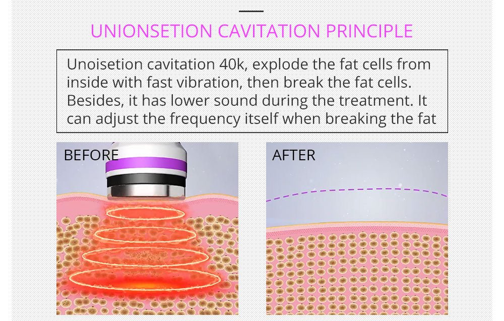 Shape Tactics 5-in-1 RF Cavitation Body Contouring System - Renee Lane Company