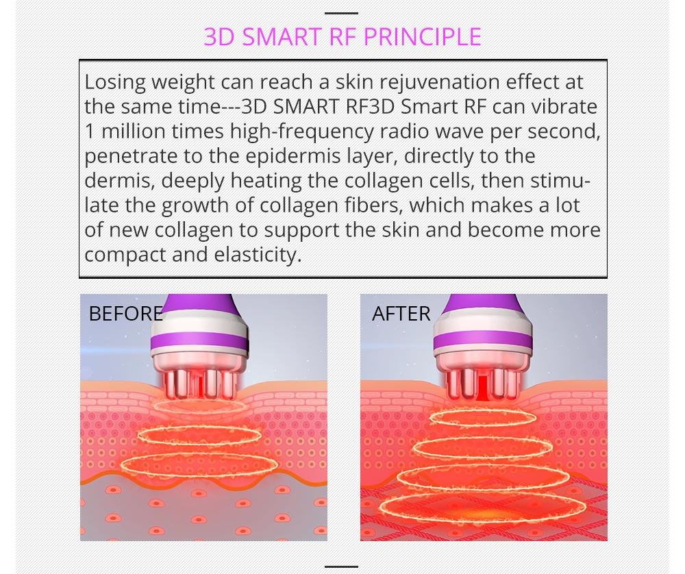 Shape Tactics 5-in-1 RF Cavitation Body Contouring System - Renee Lane Company