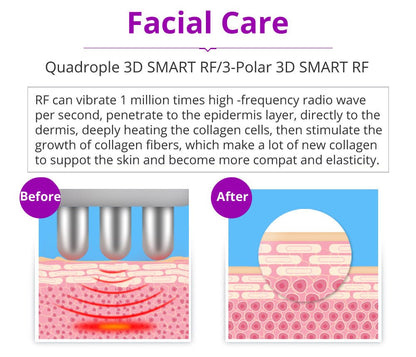 Shape Tactics 5-in-1 RF Cavitation Wellness System - Renee Lane Company