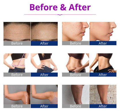 Shape Tactics 5-in-1 RF Cavitation Wellness System - Renee Lane Company