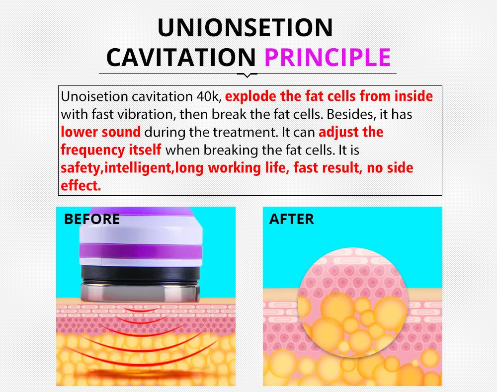 Shape Tactics 5-in-1 Ultrasonic Cavitation Vacuum RF Beauty System - Renee Lane Company