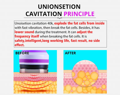 Shape Tactics 5-in-1 Ultrasonic Cavitation Vacuum RF Beauty System - Renee Lane Company