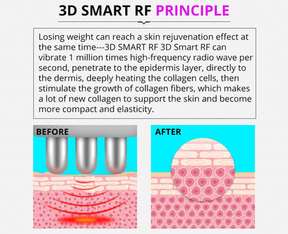 Shape Tactics 5-in-1 Ultrasonic Cavitation Vacuum RF Beauty System - Renee Lane Company