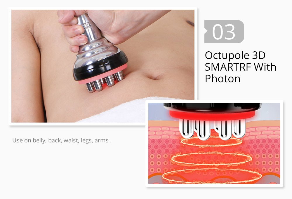Shape Tactics 5-in-1 Unoisetion Cavitation 2.0 3D Smart Vacuum RF System - Renee Lane Company