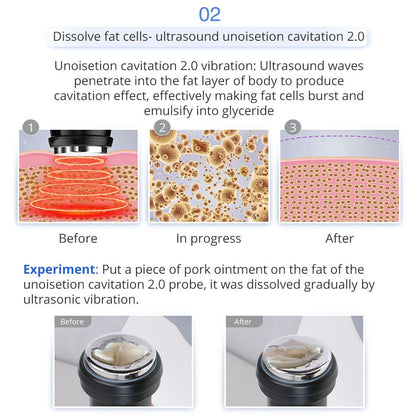 Shape Tactics 5-in-1 Unoisetion Ultrasonic RF Cavitation System - Renee Lane Company