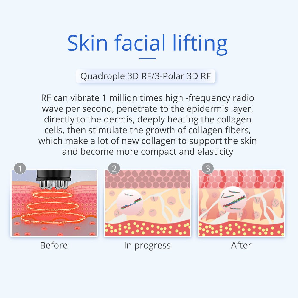 Shape Tactics 5-in-1 Unoisetion Ultrasonic RF Cavitation System - Renee Lane Company