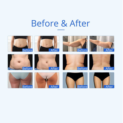Shape Tactics 5-in-1 Unoisetion Ultrasonic RF Cavitation System - Renee Lane Company