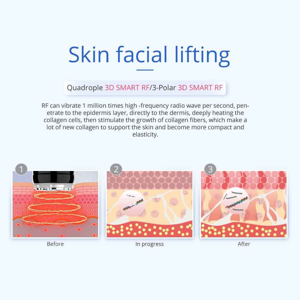 Shape Tactics 5-in-1 Unoisetion Vacuum RF System - Renee Lane Company
