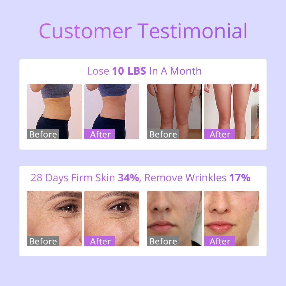 Shape Tactics 6-in-1 30K Cavitation Vacuum Lipo RF - Renee Lane Company
