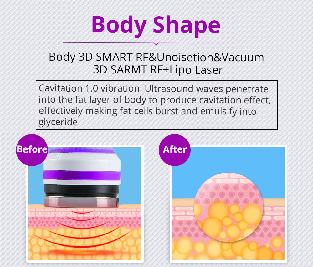 Shape Tactics 6-in-1 40K LED RF Wellness System - Renee Lane Company