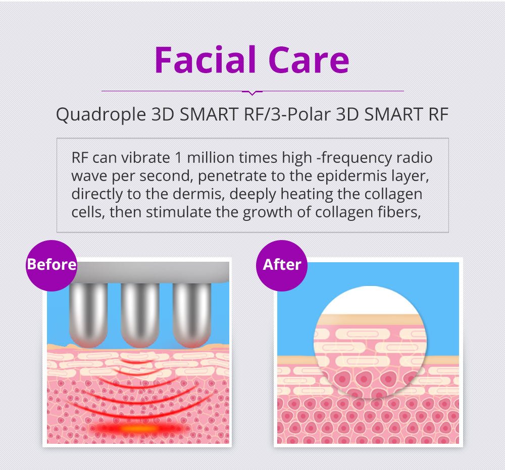 Shape Tactics 6-in-1 40K LED RF Wellness System - Renee Lane Company