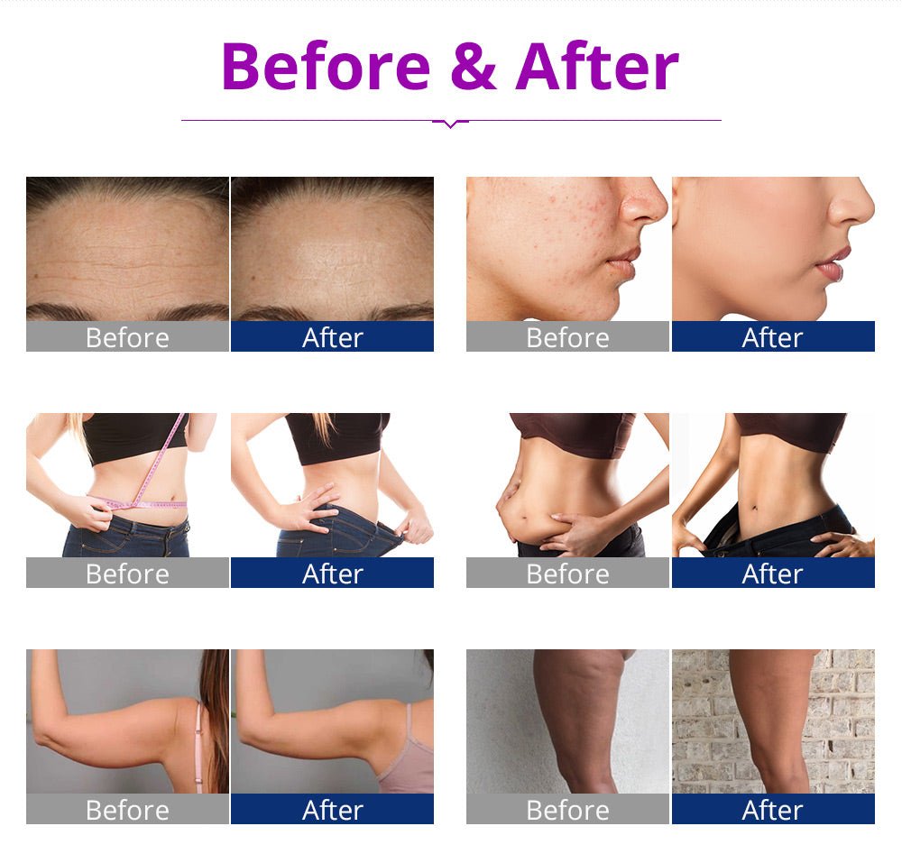 Shape Tactics 6-in-1 Cavitation RF LED Laser Lipo System - Renee Lane Company