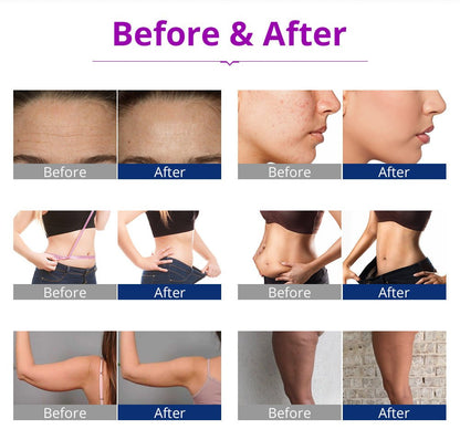 Shape Tactics 6-in-1 Cavitation RF LED Laser Lipo System - Renee Lane Company