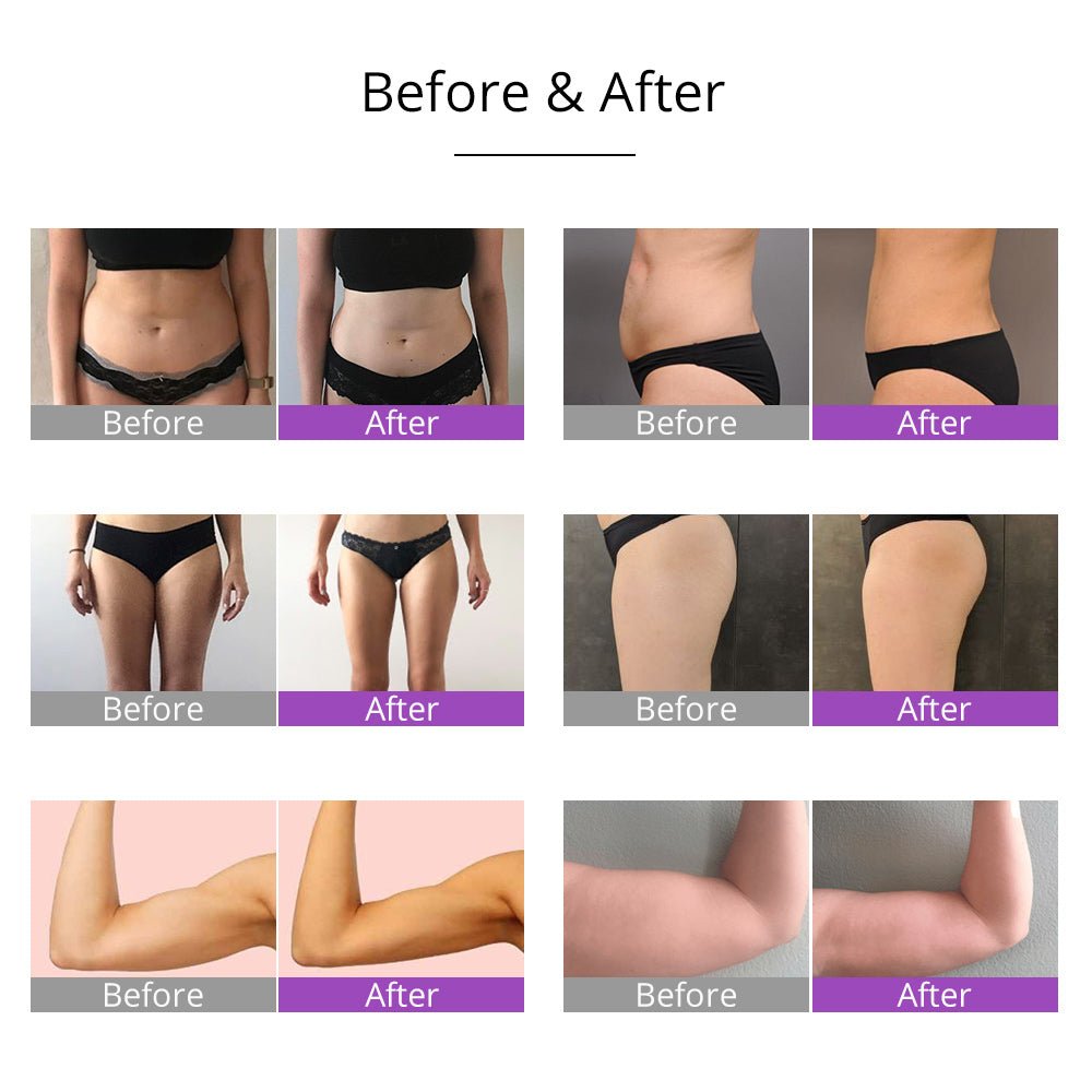 Shape Tactics 6-in-1 Cavitation RF Vacuum Lipo Laser Contouring System - Renee Lane Company