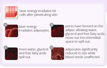 Shape Tactics 6-in-1 Ultrasonic RF Lipo Laser Contouring System - Renee Lane Company