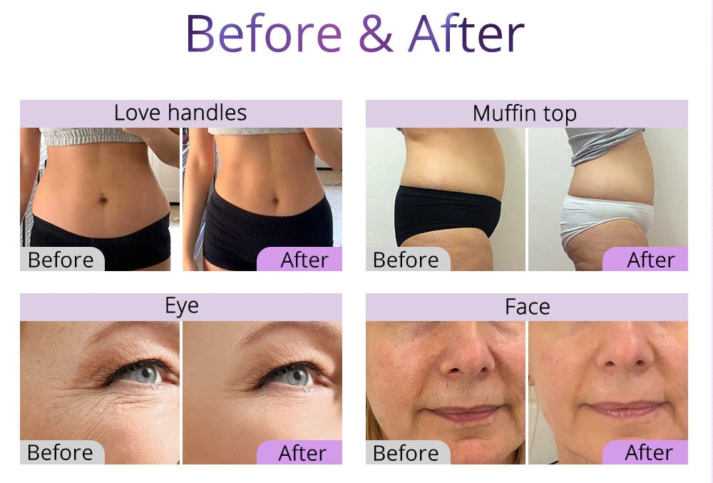 Shape Tactics 6-in-1 Ultrasonic RF Lipo Laser Contouring System - Renee Lane Company