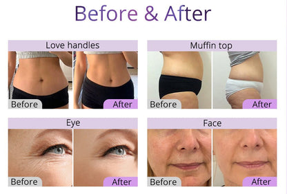 Shape Tactics 6-in-1 Ultrasonic RF Lipo Laser Contouring System - Renee Lane Company