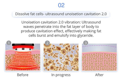 Shape Tactics 6-in-1 Unoisetion Cavitation 2.0 Vacuum RF System - Renee Lane Company