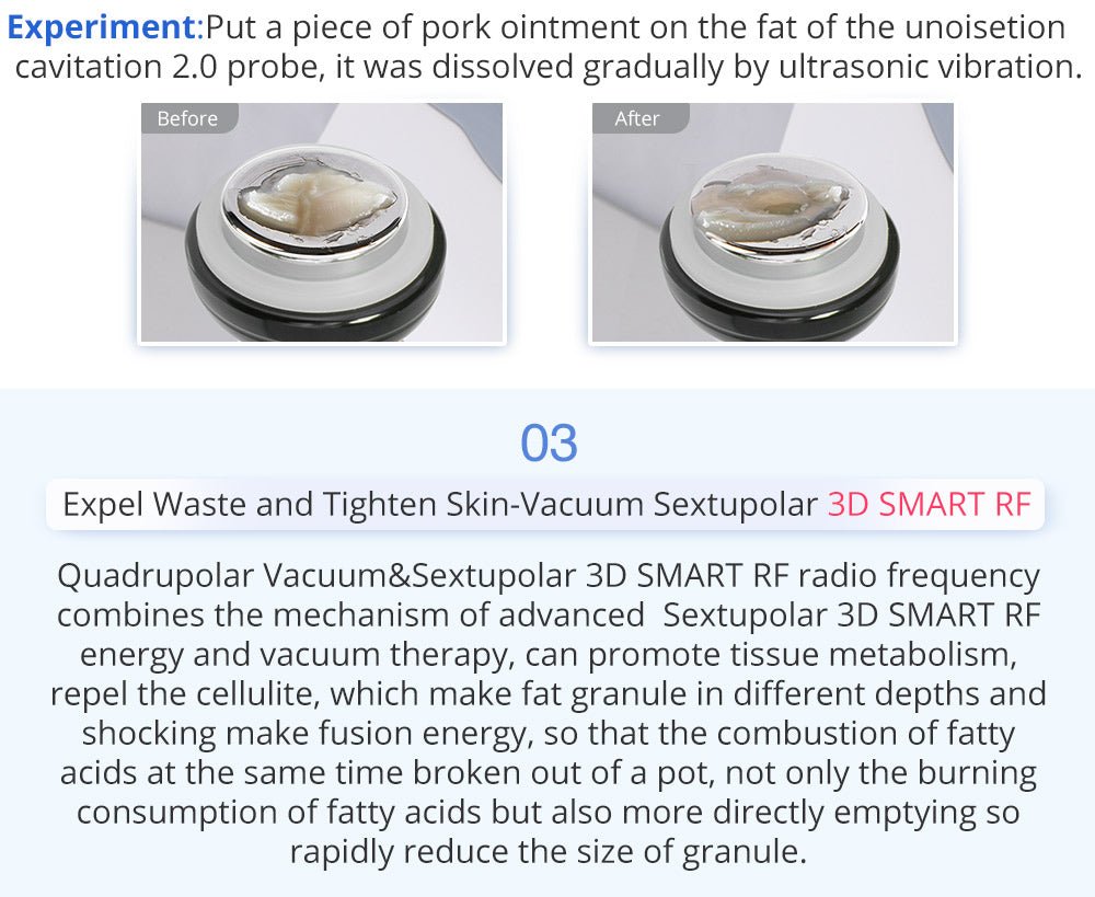 Shape Tactics 6-in-1 Unoisetion Cavitation 2.0 Vacuum RF System - Renee Lane Company